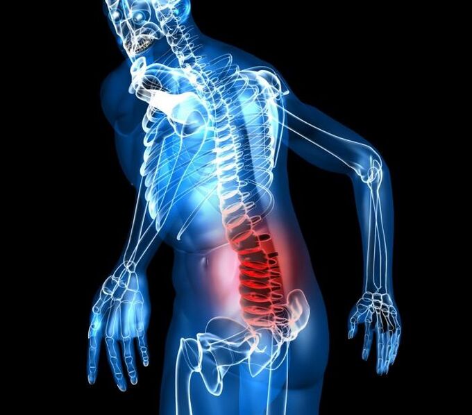 Degree and development stadiums of lumbar osteochondosis
