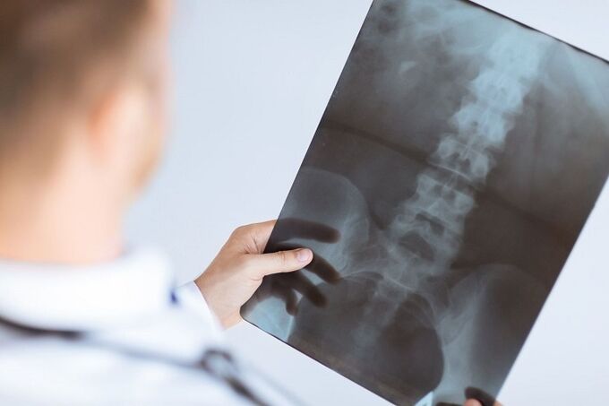 Diagnostic options for lumbar osteochondosis