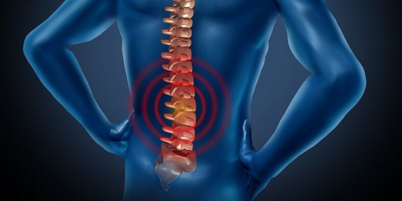 Osteochondrosis of the lumbar region