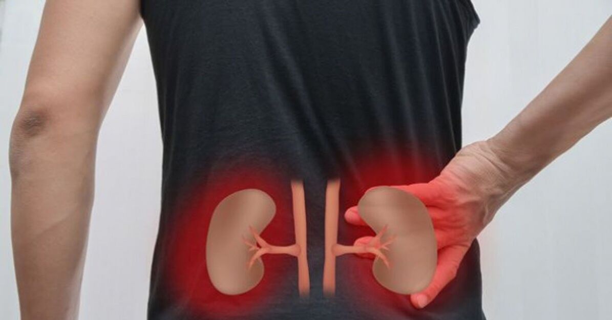 Inflammation of the kidneys can cause lower back pain